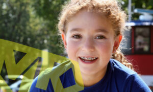 Understanding braces