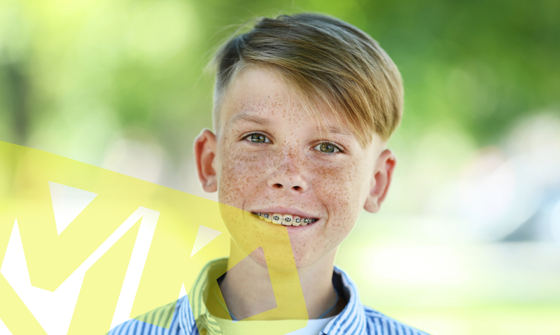 Answers to braces FAQs