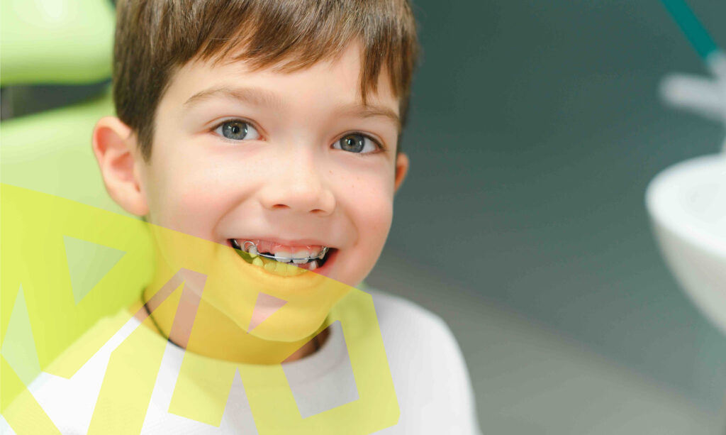 Understanding orthodontic retainers.