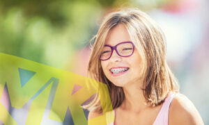 Do you know the history of braces