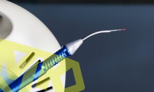 Benefits of laser dentistry.